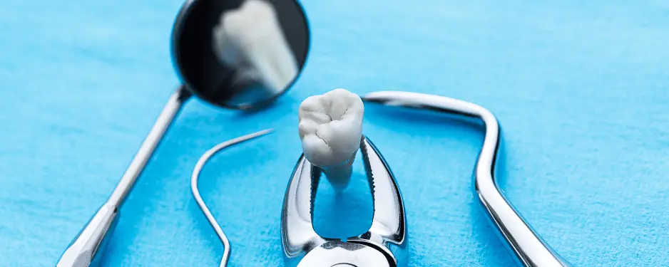 tooth extraction in Plano, TX